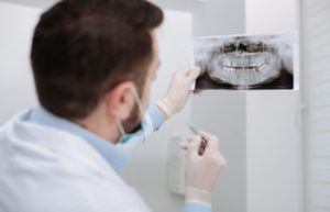 Dentist Looking at Dental X Rays Dunwoody GA