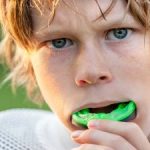 Custom Mouthguards Dunwoody GA