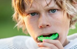 Custom Mouthguards Dunwoody GA